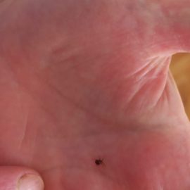 Koltukta küçük böcekler ARM TR Community